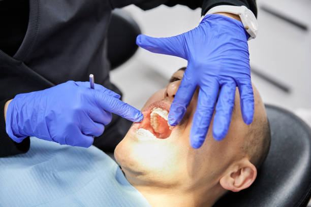 Best Root Canal Emergency Dentist  in Marshall, MI